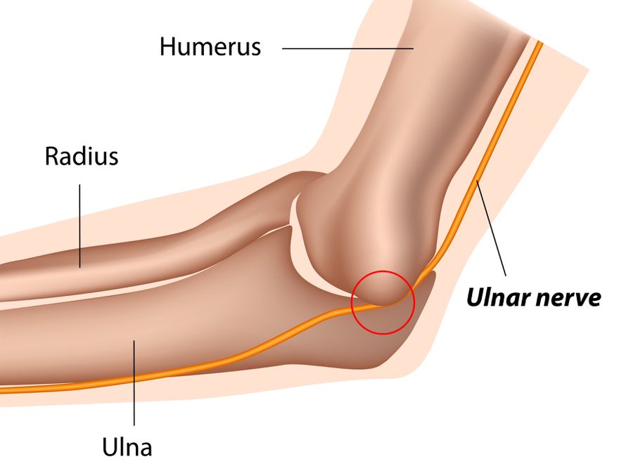 Sinir Sikismasi Ameliyat Com