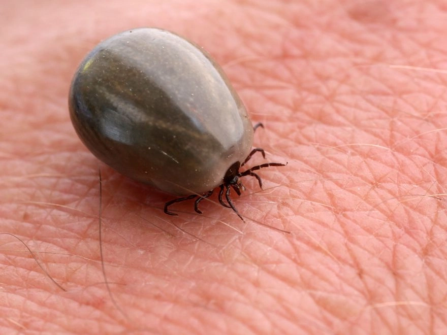 Lyme Hastaligi Ameliyat Com