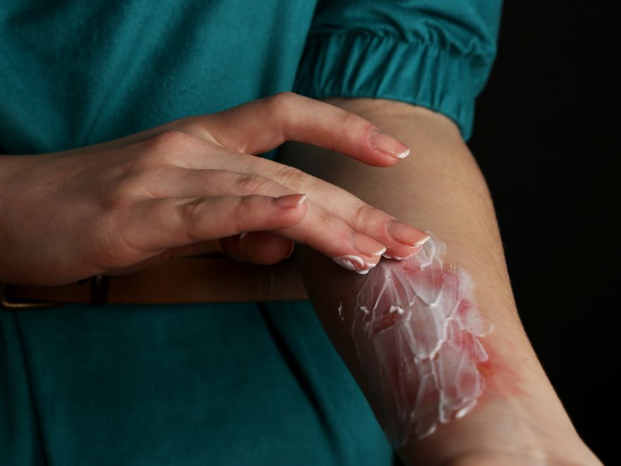 Yanik Tedavisi Ameliyat Com