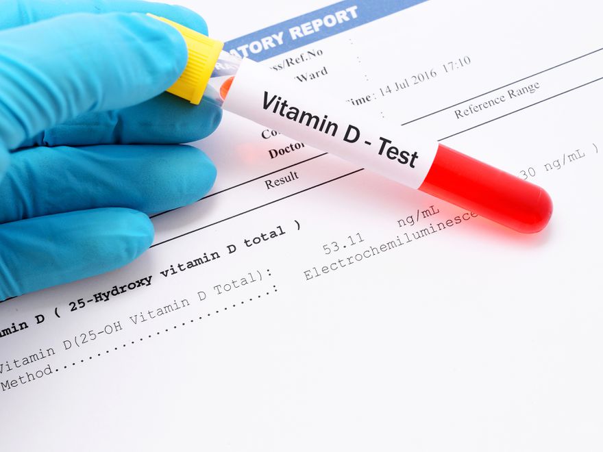 D Vitamini Eksikliği Tedavisi