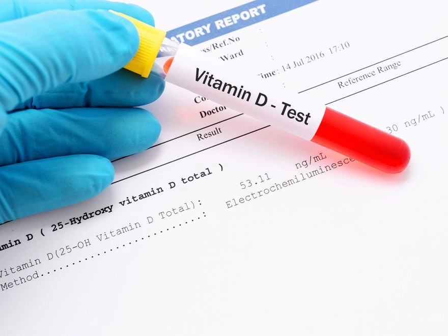 D Vitamini Eksikliği Tedavisi